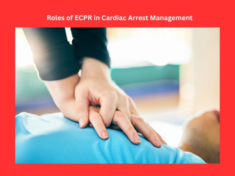 roles of ecpr in cardiac arrest management