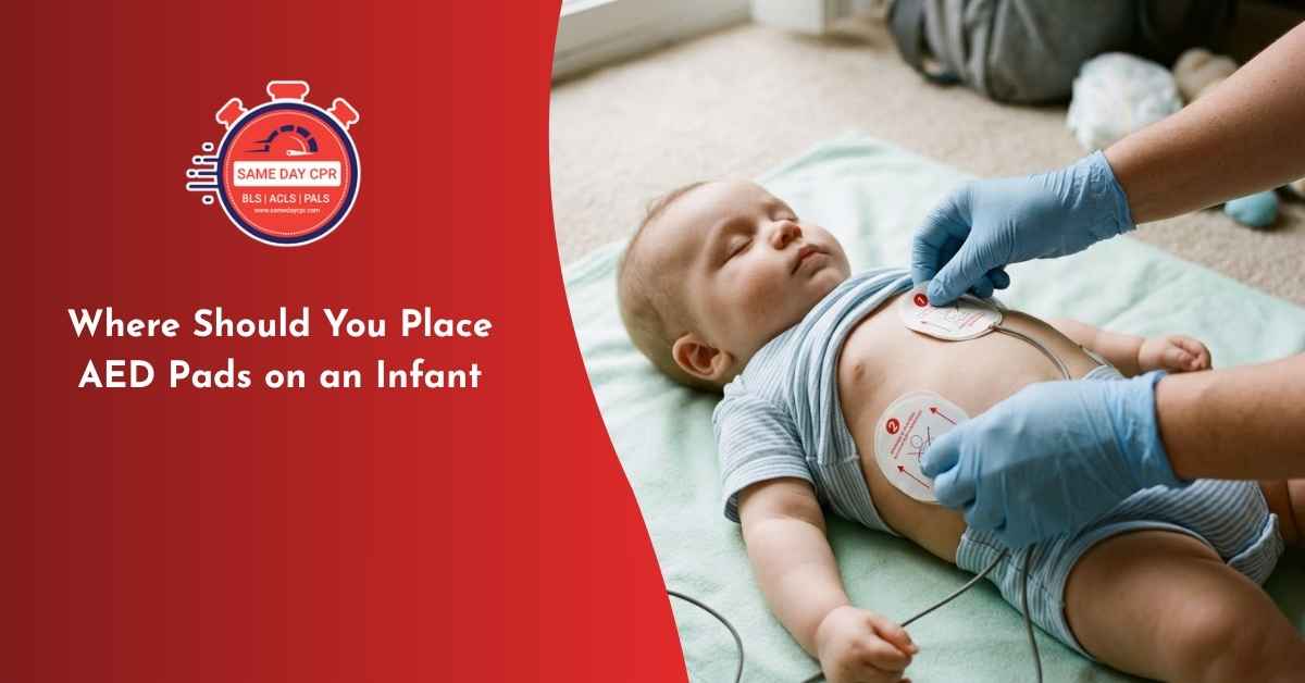 where-should-you-place-aed-pads-on-an-infant